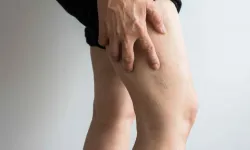 Bacaklardaki Kan Pıhtılaşması Ani Ölümlere Neden Olabilir 