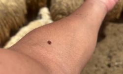 Keneyle ilgili kafa karıştıran açıklama: Gerekirse kendiniz çıkarın...