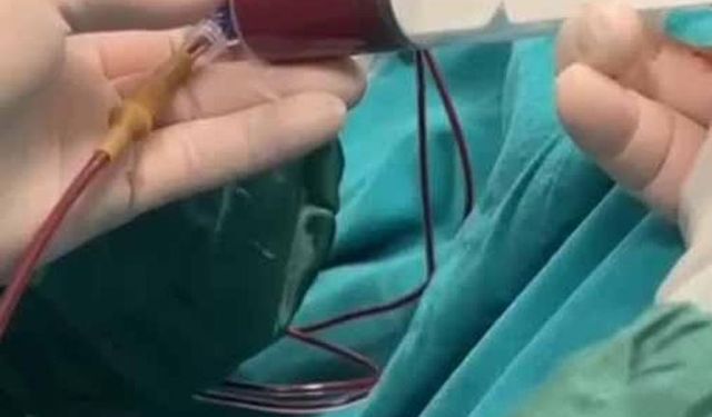 Anne karnındaki bebeğe kan nakli yapıldı