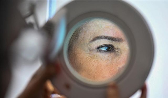 Melanom, cinsiyete göre vücudun farklı bölgelerinde yaygın