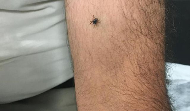 Kene vakalarında doğru bilinen çok fazla yanlış var!