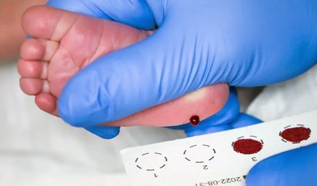 Fenilketonüri  hastalığı nedir? Sivas'ta uzmanı açıkladı!