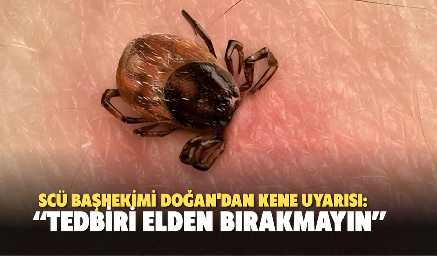 SCÜ Başhekimi Doğan'dan kene uyarısı: “Tedbiri Elden Bırakmayın”